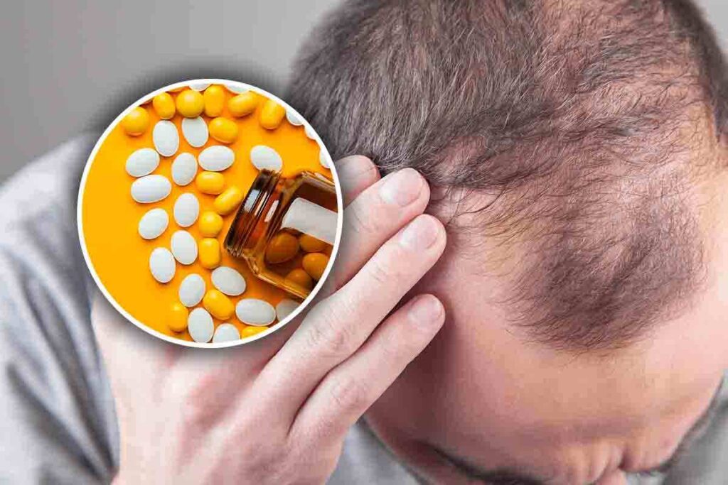 effetti collaterali farmaco contro caduta dei capelli