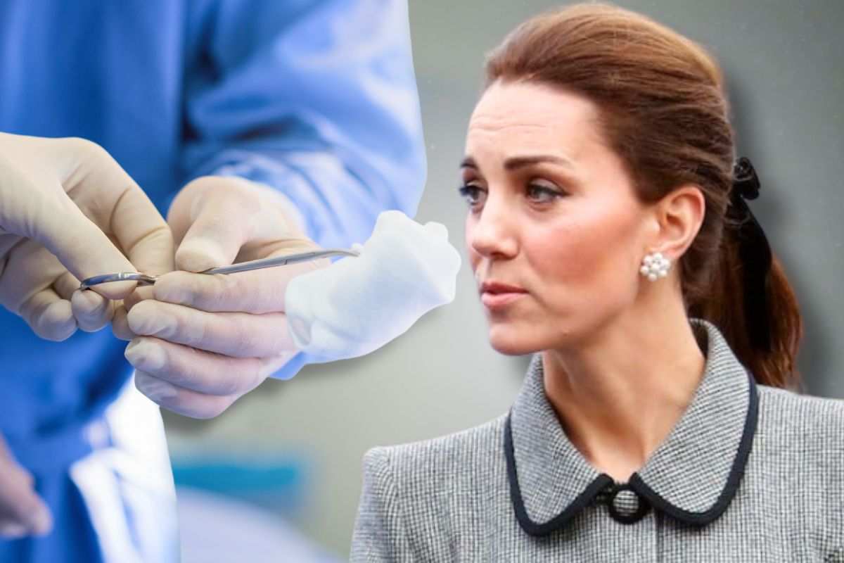 Kate Middleton operata medici italiani